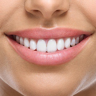 smile with gum recontouring