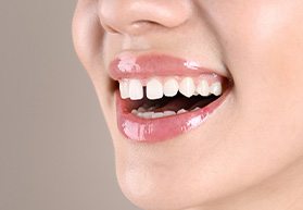 A woman with a gap between her front teeth