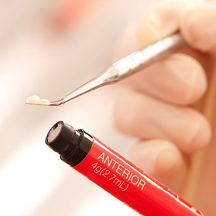 composite resin on a dental tool