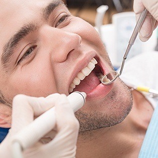 man getting cerec