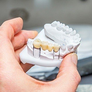 four tooth bridge