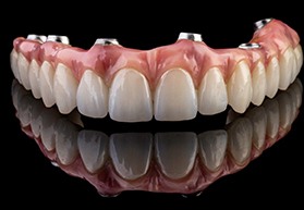 Implant dentures for upper arch on reflective surface