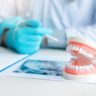 Model of dentures in Bergenfield lying on X-ray