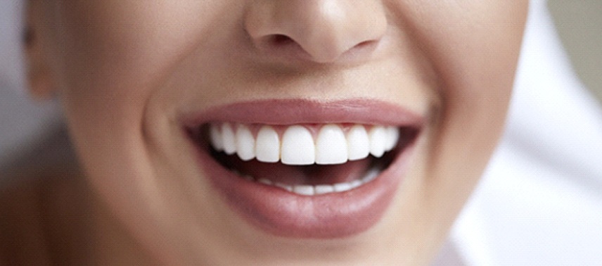 An up-close view of a person’s smile after completing teeth whitening in Bergenfield