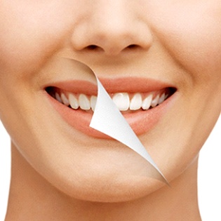 A digital image of a person’s smile being pulled back to reveal a whiter, brighter smile