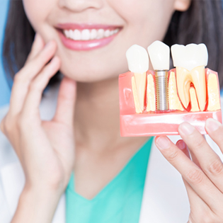 Dentist holding up a model of a dental implant