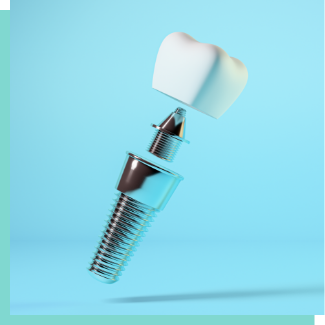 Diagram of dental implants in Bergenfield