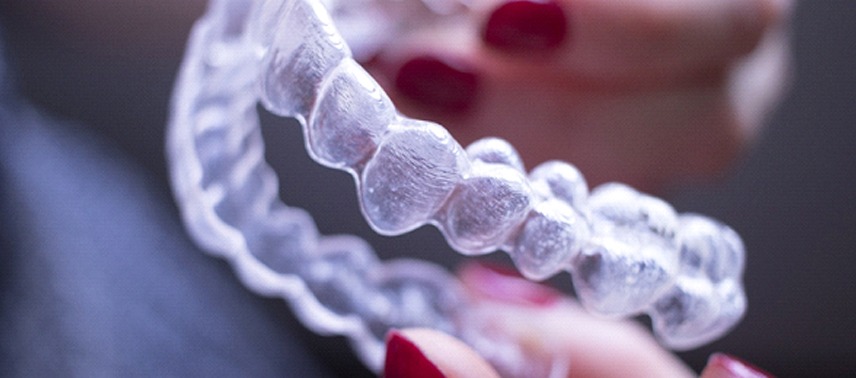 Invisalign aligners