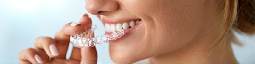 Invisalign® Clear Aligners, Cosmetic Dentist Bergenfield