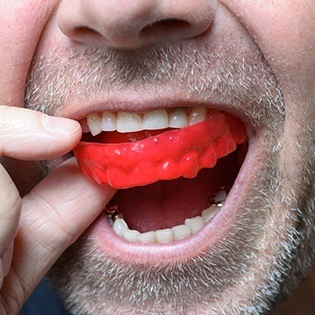 red mouthguard