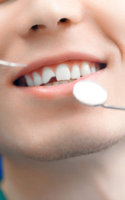 A man with a chipped tooth