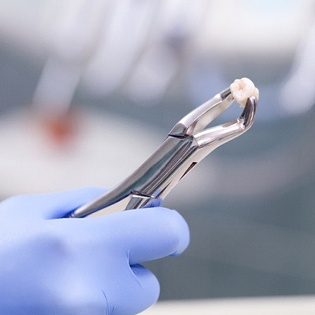 A dental professional wearing a glove and holding a pair of dental forceps that have been used to extract a wisdom tooth