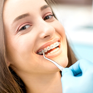 A young female smiling to expose her metal braces while a dentist uses dental forceps to check her wire