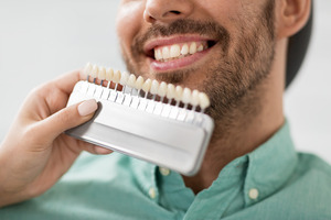 Using color guide to check shade of male patient’s teeth